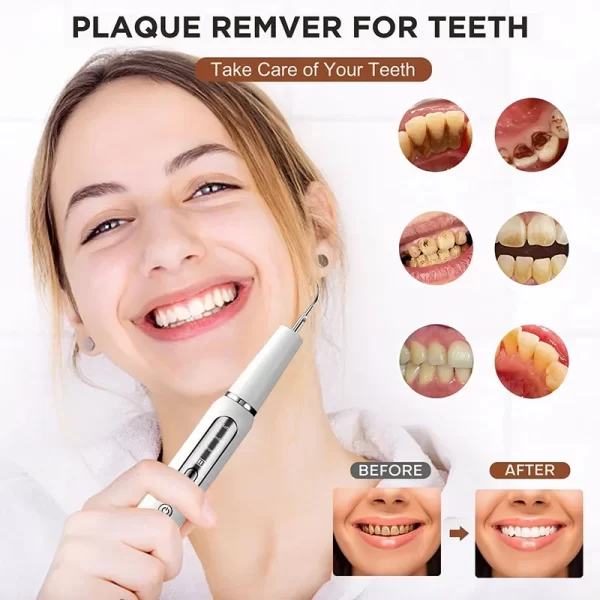 Ultrasonic Toothbrush for Dogs and Cats Removes Tartar and Plaque Pet Dental Care Kit Pet Tartar Remover Tooth Cleaning Tool - Image 13